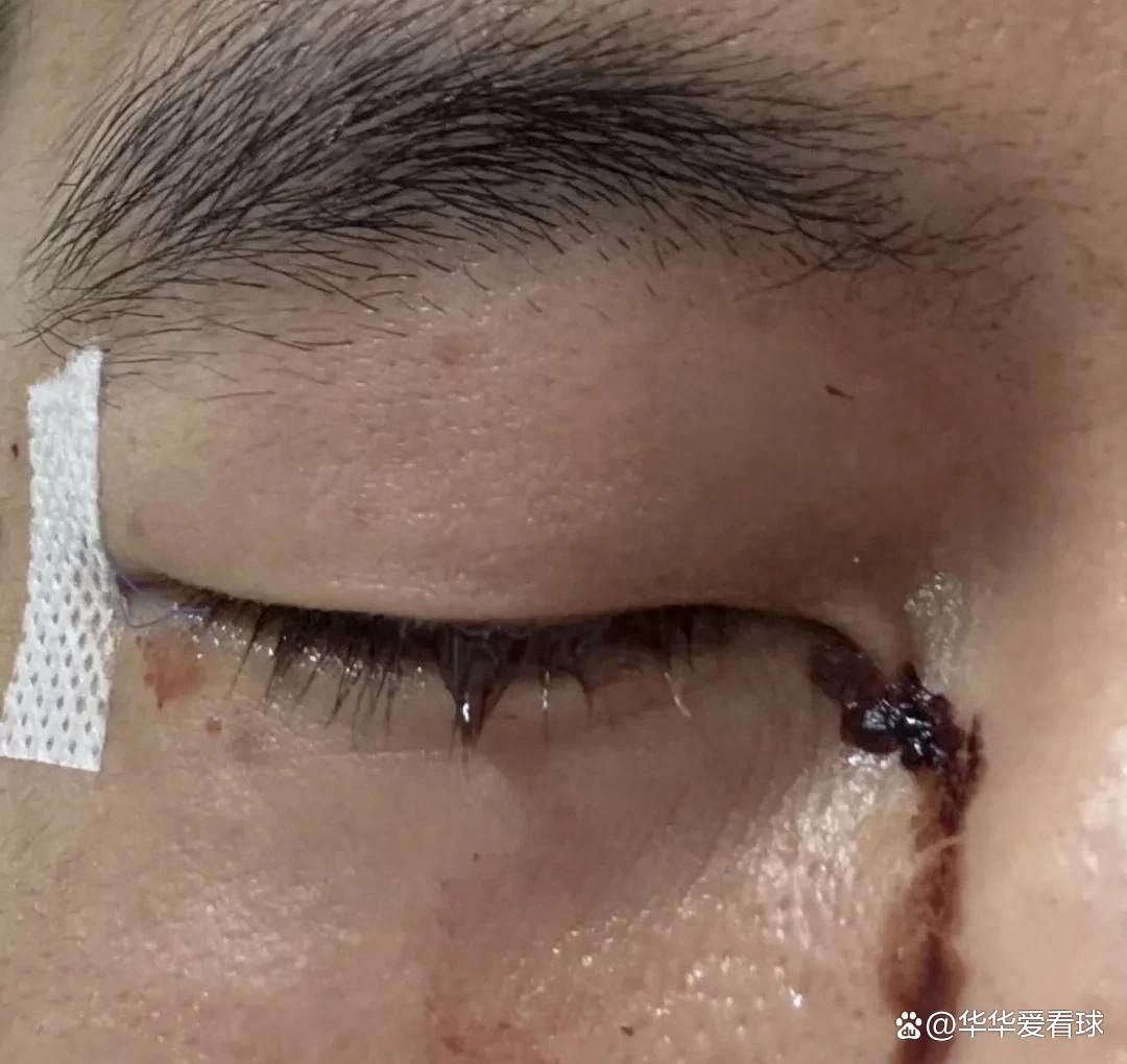 球员意外受伤，比赛现场陷入紧张